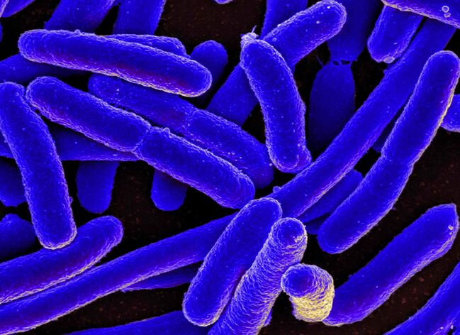 L'E. coli innesca molto spesso lo sviluppo della cistite nelle donne